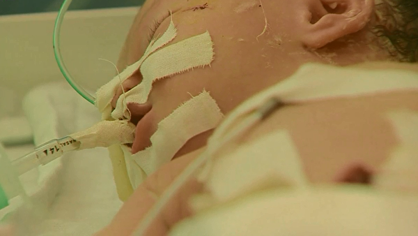 The girl – who has not yet been given a name – is being cared for in hospital, where doctors say she has a 50 percent chance of survival. (Still courtesy of the BBC)