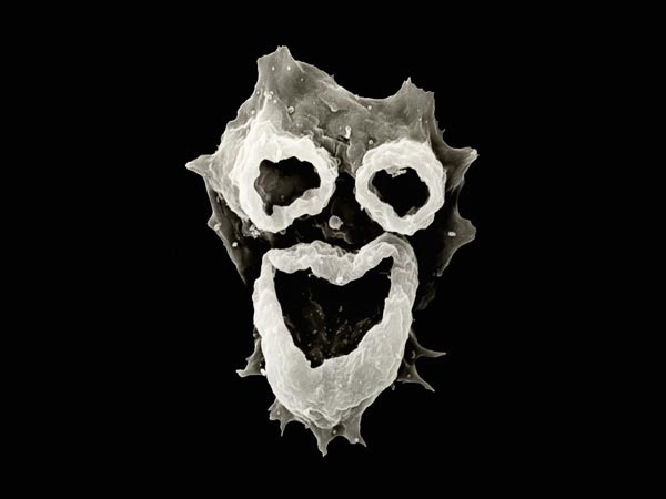 アメーバ「フォーラーネグレリア」（Naegleria fowleri）の電子顕微鏡写真。人の顔のように見える。